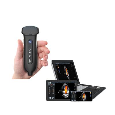 A ponta de prova móvel de Ultrasonication da máquina do ultrassom da mão apoiou Windows/Android/IOS