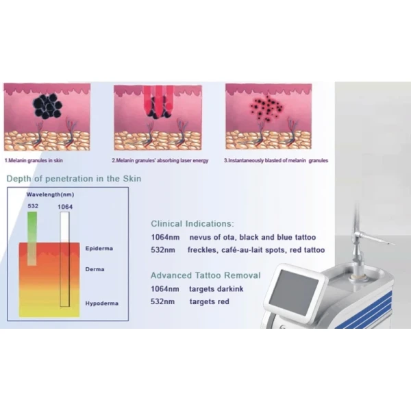 Nd Yag Laser Skin Rejuvenation Picosecond Machine for Tattoo Removal and Skin Whitening