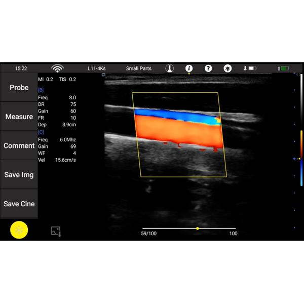 Transvaginal Handheld Portable Ultrasound Device Convex Linear Cardiac Probe Detachable