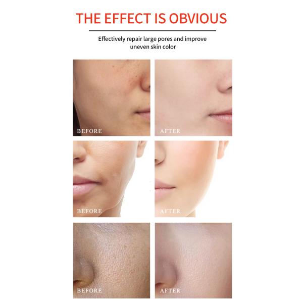 OEM Facial Serum Whitening Anti Wrinkle Vitamin C Serum For Face
