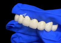 Lava de alta translucidez Zirconia ponte dental mistura sem costura com dentes naturais