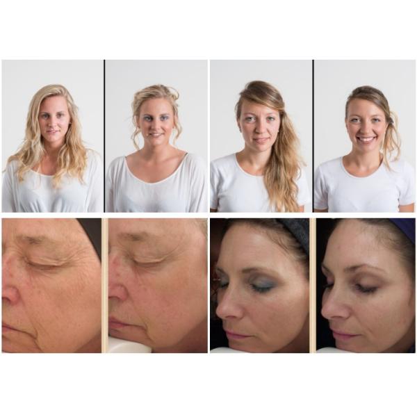 Польза света воды впрыски оружия Mesotherapy CE Nano