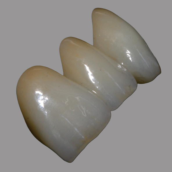 Dental Lab Zirconia Price | Natural Full Contour Zirconia Bridge Single Unit / Multiunit Wear Resistant