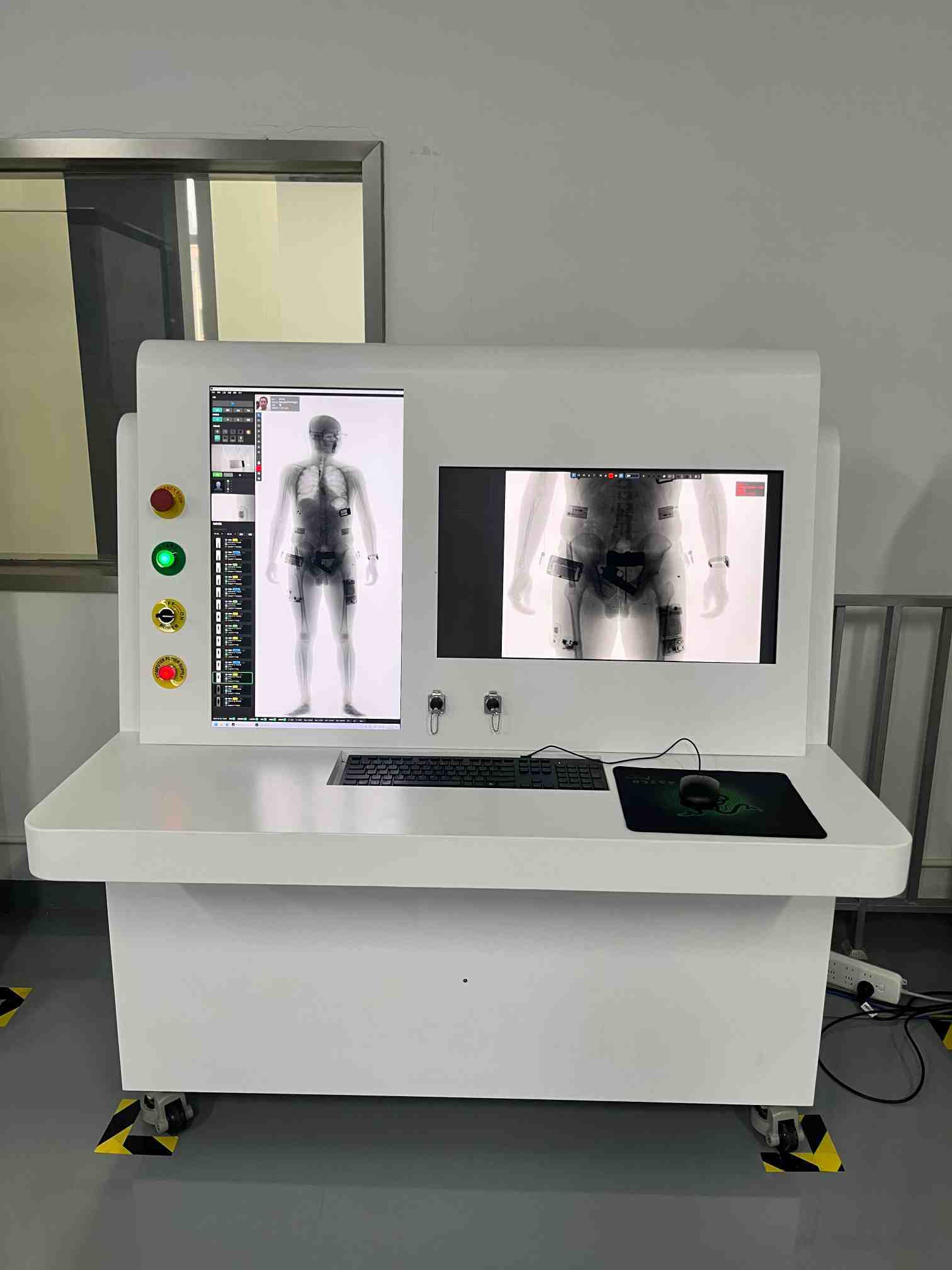 Advanced Security Screening System Non Intrusive Airport Scanning Machine