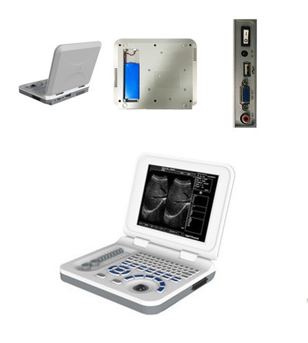 Medical Multi Language Portable Ultrasound Scanner Pregnancy Test Ultrasound