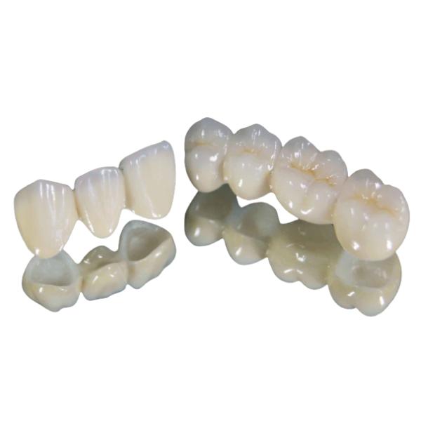 Porcelain Tooth Crown Strong Wear Resistance Color Stable High Quality