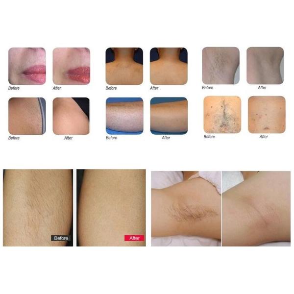 Portable IPL SHR Laser Hair Removal Machine One Handle Type For Beauty Salon