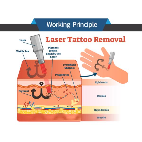 Tuv Approved Laser Tattoo Removal Equipment Q Switched Nd Yag For Beauty Salon