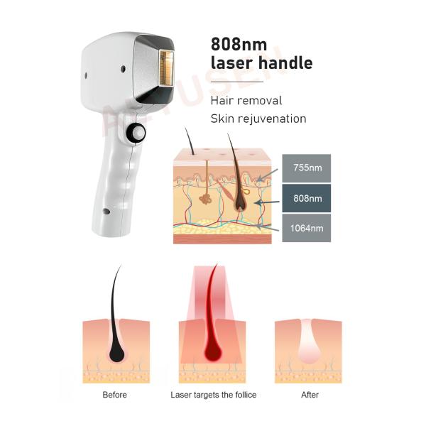 1200W Stationary Diode Laser Hair Removal Machine For Smooth And Hair-Free Skin