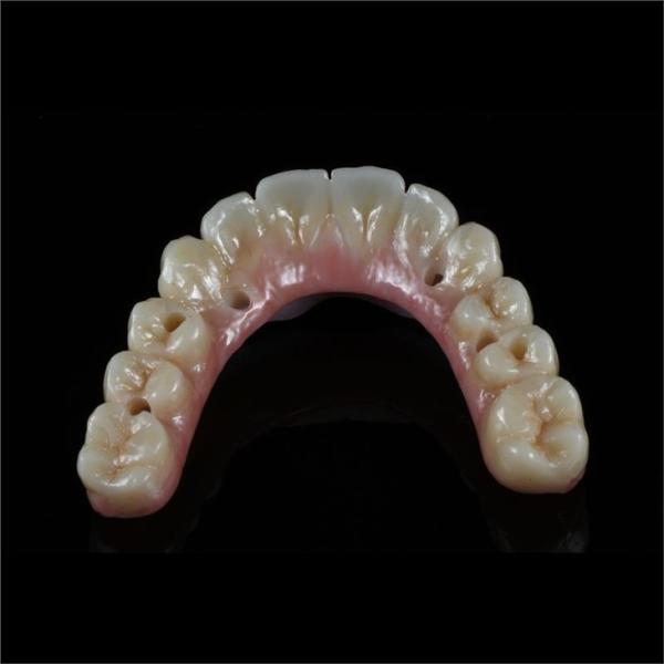 Fixed Restorations Full Arch Zirconia Implant Bridge Denture Teeth