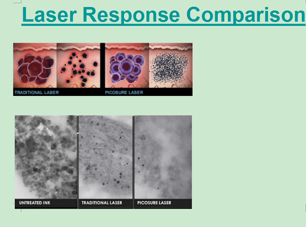 13 Language Picosecond Nd Yag Laser Tattoo Removal Equipment FDA Certificate