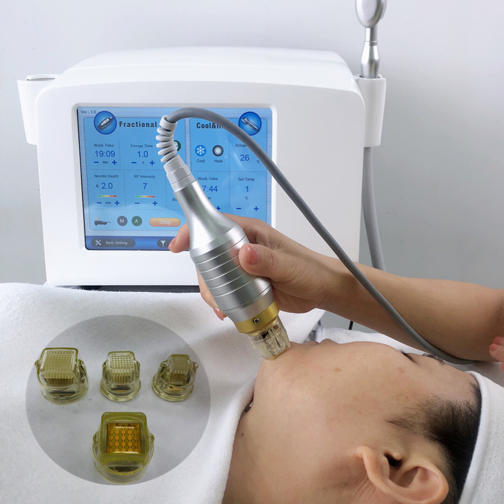 Кожа Resurfacing частичная машина RF Microneedle с холодной терапией инвазионной