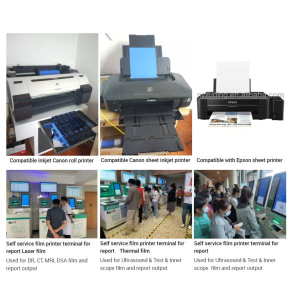 Nontoxic 180 Microns Medical X Ray Film For Ultrasound Report Output