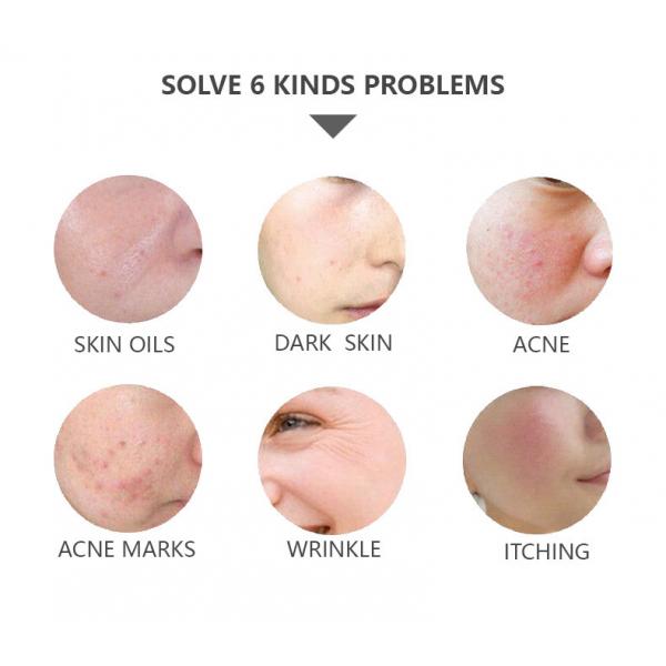 Анти- старея машина 633nm 417nm терапией фотона СИД