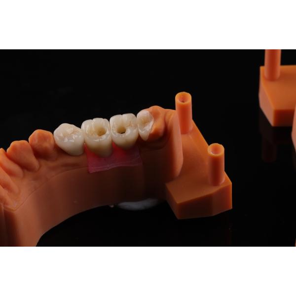 Высококачественная зубная цирконовая корона и All On Four Six Implant Full Arch / Китайская стоматологическая лаборатория