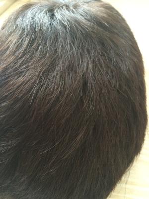 Custom Hair Replacement Systems 12-24 100% Human Hair Toupee