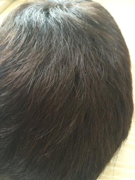 Custom Hair Replacement Systems 12-24 100% Human Hair Toupee