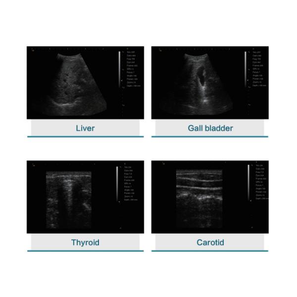 Digital Human Veterinary Portable Ultrasound Machine Ultrasound Portable Ultrasound