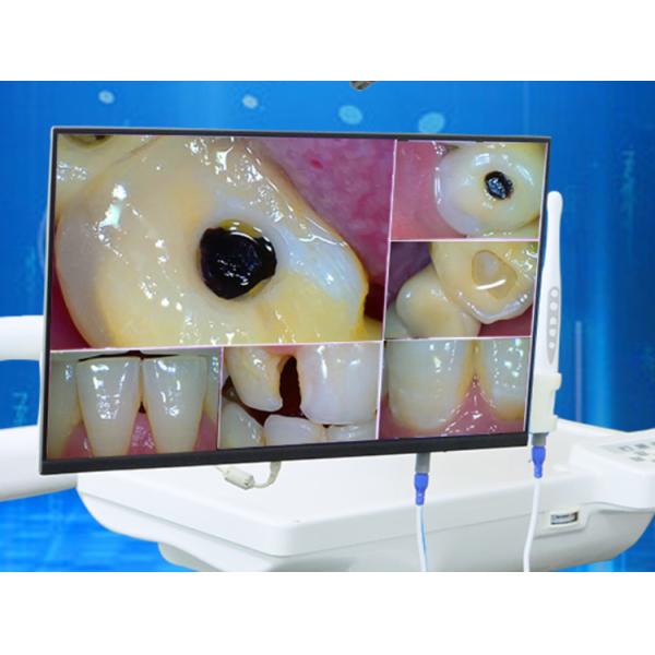 Монитор 21,5 настольного компьютера держателя стены зубоврачебный медленно двигает белая камера монитора экранного дисплея СИД LCD Intra устная