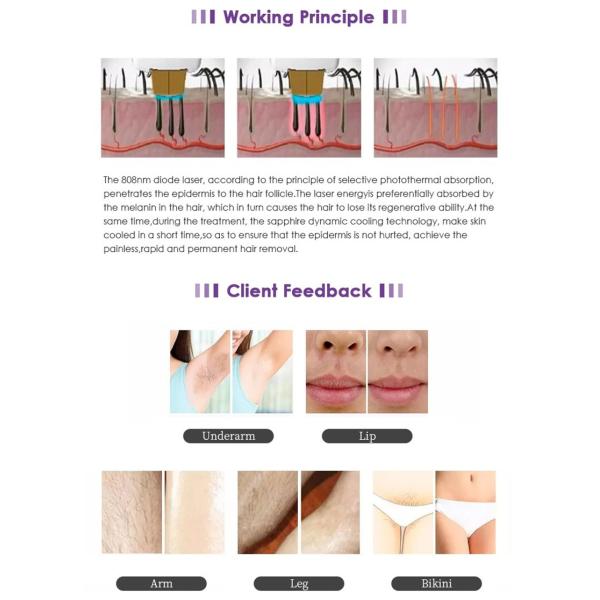 Профессиональный лазер 2 диода 808nm в 1 приборе удаления татуировки лазера пикосекунды удаления волос