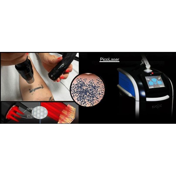 Picosured Picosecond Laser Skin Resurfacing Tattoo Removal Pico Laser Picosecond with 755nm 532nm and 1064nm Wavelengths Suitable for All Colors of Tattoo Removal and Skin