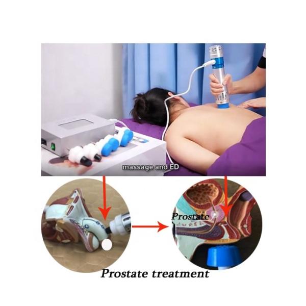 Noninvasive Mini Shockwave Therapy Devices For ED Therapy Machine 350W shockwave therapy for back pain