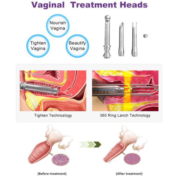 3 In 1 Fractional Co2 Laser Machine Skin Care Vaginal Tightening