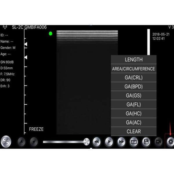 Беспроводной блок развертки линейные выпуклые фазированные 3 ультразвука Usb В 1