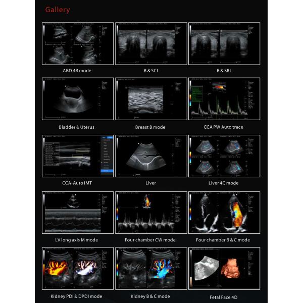 Zoncare 3D/4D Trolley Medical Digital Color Doppler Ultrasound System for Hospital