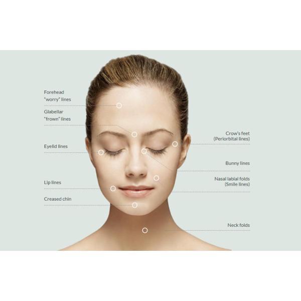 30W-200W RF Beauty Machine Scar Removal Tixel Thermal Skin Rejuvenation Machine