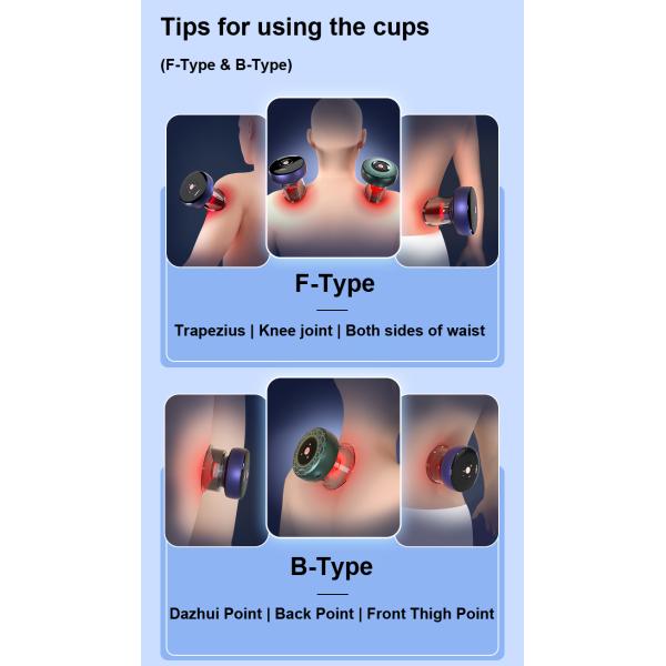 OEM/ODM Body Fitdash F-Type Cupping Cups for Customized Hijama Cupping Therapy Massager