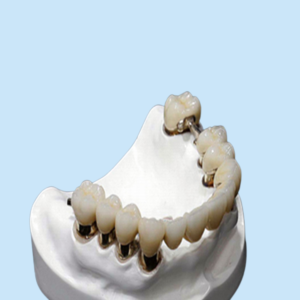 Коррозионная устойчивость Denture приложения точности CR MK1 CO