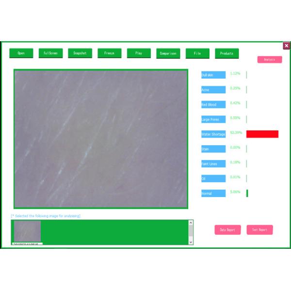 Pocket USB LCD Digital Dermatoscope Skin and Hair Analyzer With Testing Software