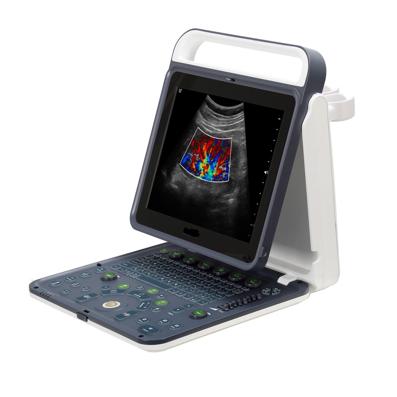 Hospital Outside 2020 New Portable Digital 15 Inch Color Doppler Ultrasound Machine