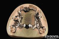 Customized Suppleness Metal Framework Dental Biocompatible Material
