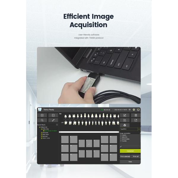 Датчик РВГ рентгеновского снимка КМОС ИнтраОрал цифров зубоврачебный для удара клиники БФ анти-