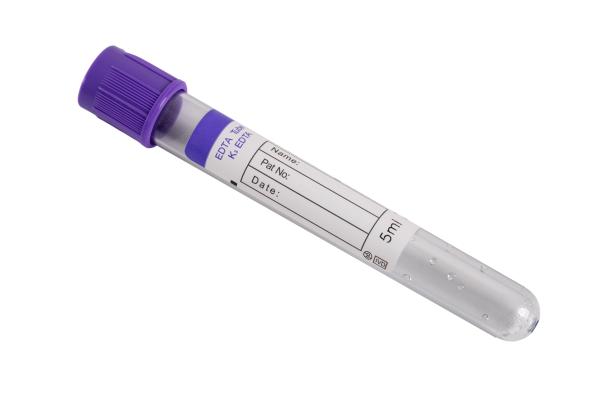 EDTA K2/K3 Blood Collection Tube 5ml for Hematology Testing