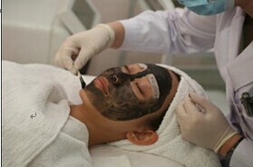 Tattoo removal q switch nd yag laser carbon peeling,skin rejuvenation pigmentation removal beauty device Mi