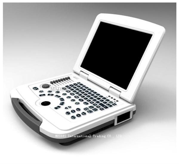 Clinic Hospital  Obstetrics and Gynecology Department Laptop Ultrasound Machine with Battery