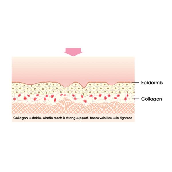 Home Ultrasound Beauty Machine , Rf Skin Tightening Machine Shrink Enlarged Pores