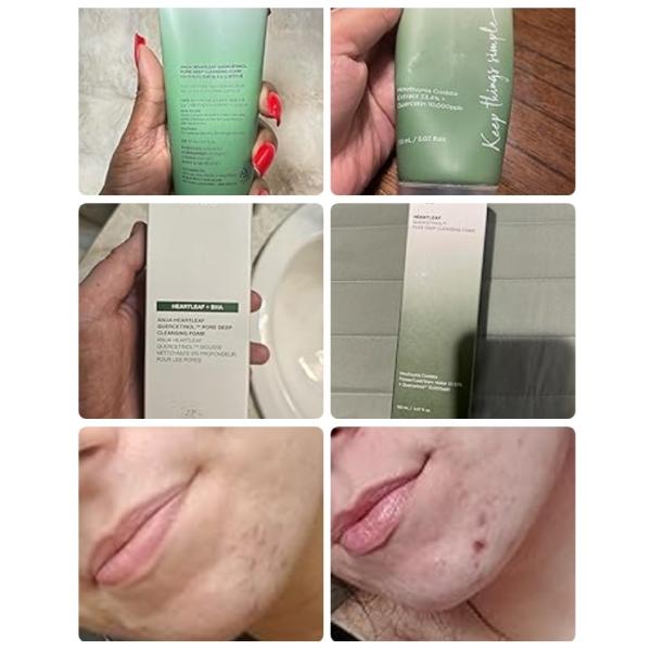 Korean Heartleaf Quercetinol Moisturizing Facial Cleanser Foam BHA Hyaluronic Acid Blackhead Remover 150ml 5.07oz