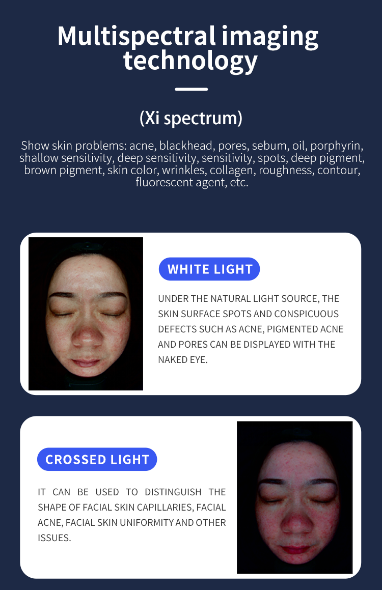 X5 Pro AI Facial Skin Analyzer Multi-spectrum Face Scanner Salon Skin Diagnosis Equipment