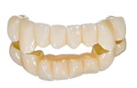 Ponte dental saudável da coroa de grande resistência e para fazer o sorriso mais bonito