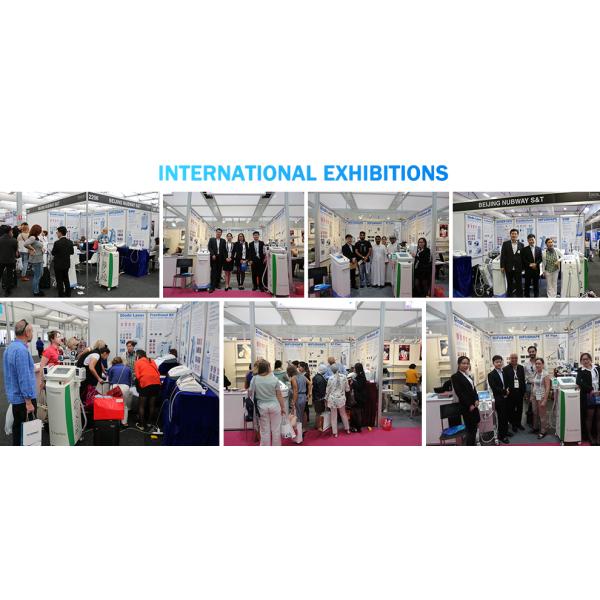 2017 Newest design tattoo removal/freckle removal/birth mark removal/hair remove/vascular remove Q Switched Nd Yag Laser