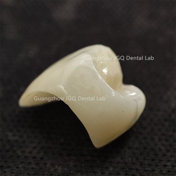 All Ceramic Crown Bridge Dental Laboratory Natural Looking With Aesthetic Effect