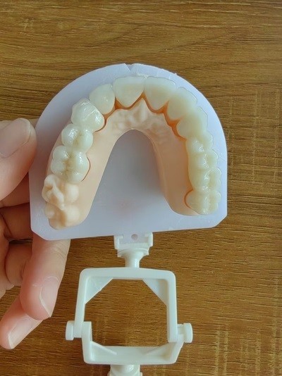Coronas de zircónia resistentes a la corrosión con aspecto natural Dientes de zircónia