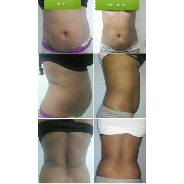 5D Upgraded Lipo Laser Slimming Machine For Tummy Fat 650nm 808nm 980nm