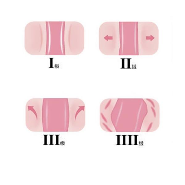 Women Calendula Officinalis Vaginal Health Products Hygiene Wash Foam Moisturizing Balancing