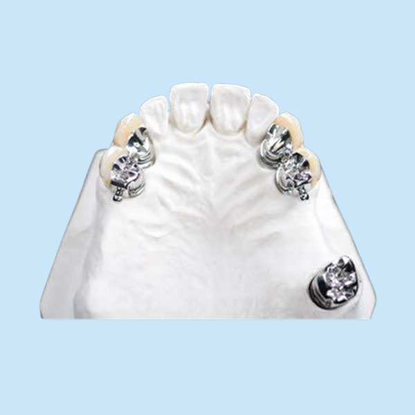 Denture легкого чистого приложения точности OEM частично пятнает устойчивый