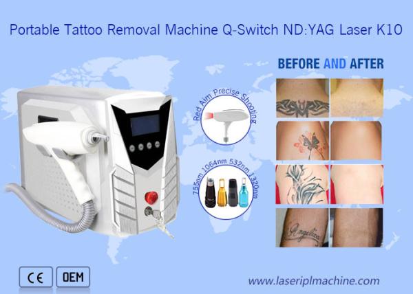 1064nm 532nm Laser Tattoo Removal Machine Portable With Detachable Handle